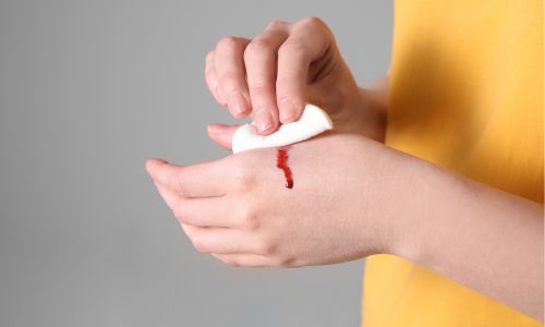 Stop the Bleed